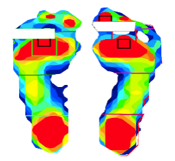 ForceMapping-Foot 足底壓力分布測試系統(tǒng)